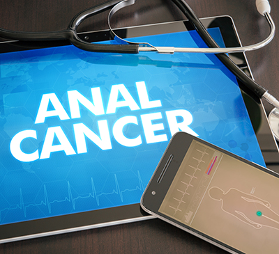 Anal Cancer - A Pipeline Analysis Report